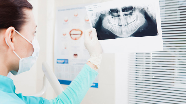 親知らずの放置はNG さくら 南草津の歯医者