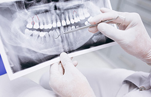 ニーズに合った治療 さくら 南草津の歯医者