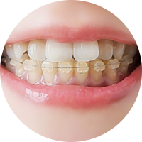 矯正歯科 さくら 南草津の歯医者